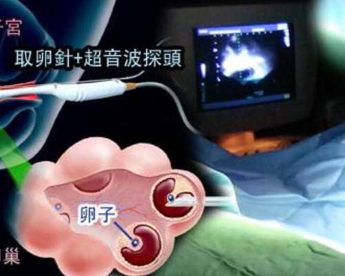 中国传承国际助孕中心什么样|三代试管婴儿一次成功率高吗