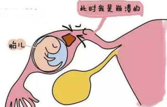 海外供卵试管_蓓贝天使生殖中心_试管婴儿和正常怀孕的区别？北京哪些医院可